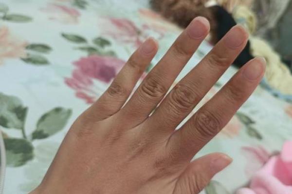 手背有肉肉，命运的秘密与幸福的象征