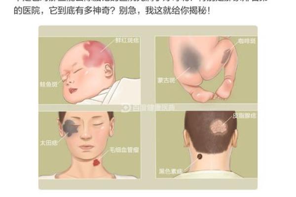 脖子左边有胎记的人命运解析:命运与胎记的神秘联系 脖子左边有胎记的人命运解析:命运与胎记的神秘联系