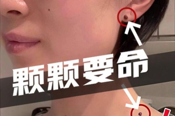 脖子左边有胎记的人命运解析:命运与胎记的神秘联系 脖子左边有胎记的人命运解析:命运与胎记的神秘联系