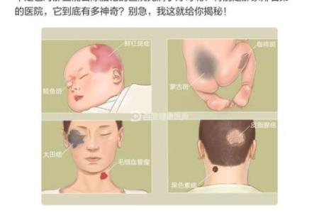 脖子左边有胎记的人命运解析：命运与胎记的神秘联系