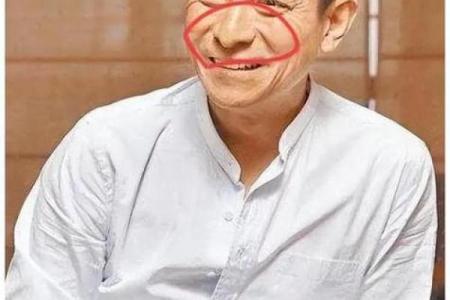 颧骨突出的男人：独特相貌与命运分析