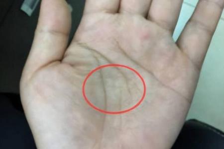 双手断掌的女人：命运的转折与人生的启示