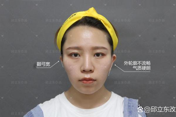 揭秘下颌凹陷：影响命运的隐秘特征与历史渊源