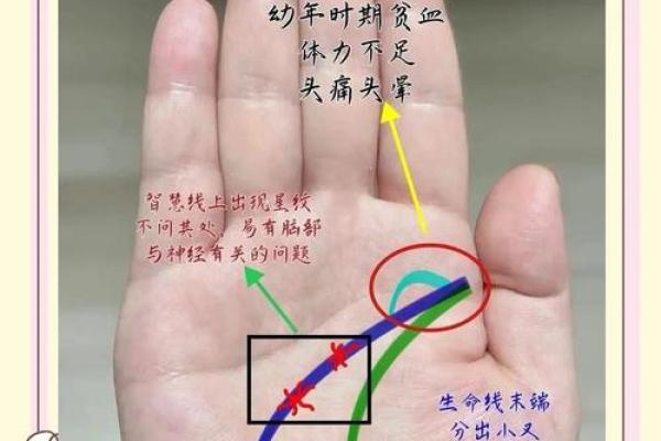 探索手相中的方块纹：揭示你的命运与性格秘密