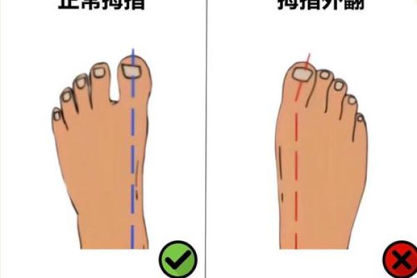 哪个脚趾长，预示你的命运走向？揭开指脚之谜！