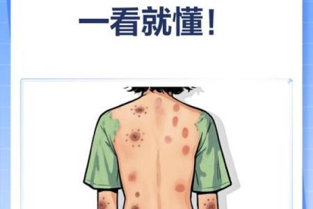 脖子左边有胎记的命运解析：你是否也有这样的疑问？